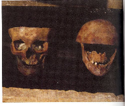 Skulls attributed to Louis XI on the right and to Charlotte de Savoie on the left - Histoire de la médecine
